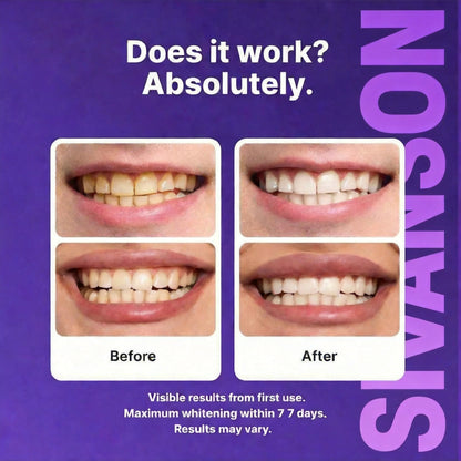 Sivanson Purple Teeth Whitening Strips